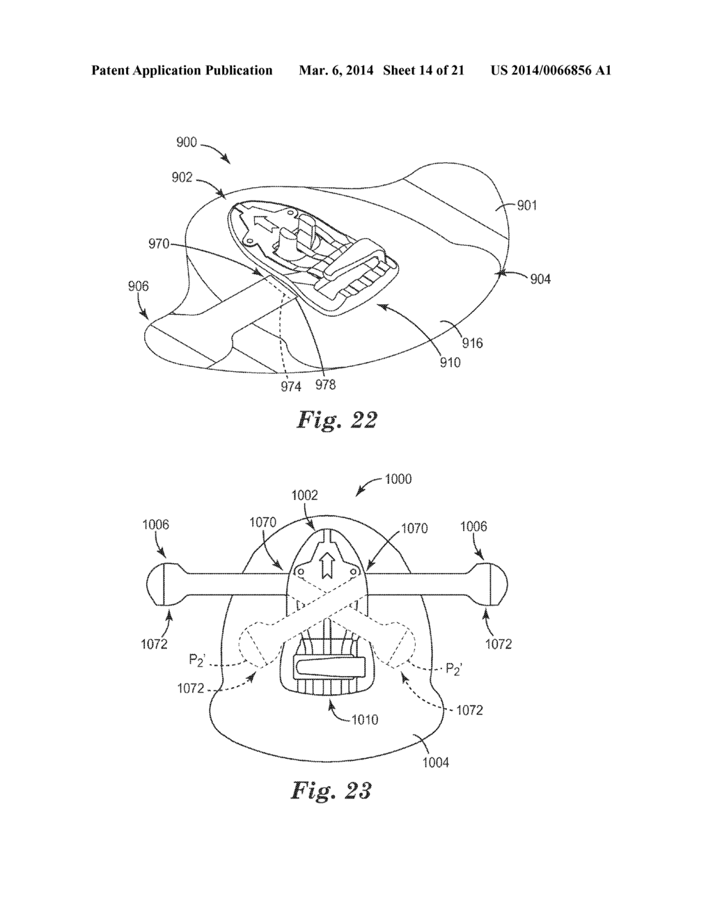 MEDICAL ARTICLE SECUREMENT SYSTEMS COMPRISING A BRACKET AND A FLAP - diagram, schematic, and image 15