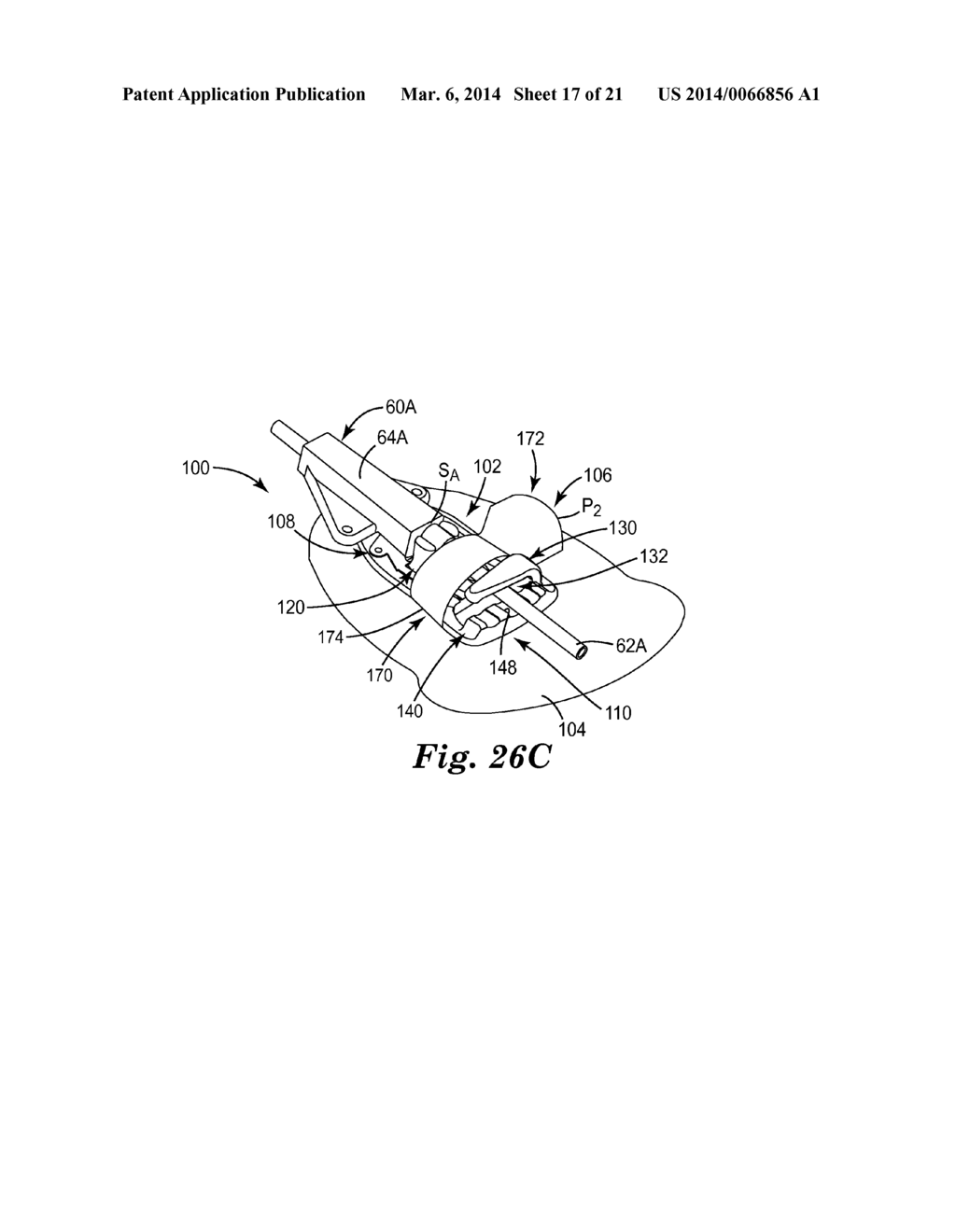 MEDICAL ARTICLE SECUREMENT SYSTEMS COMPRISING A BRACKET AND A FLAP - diagram, schematic, and image 18