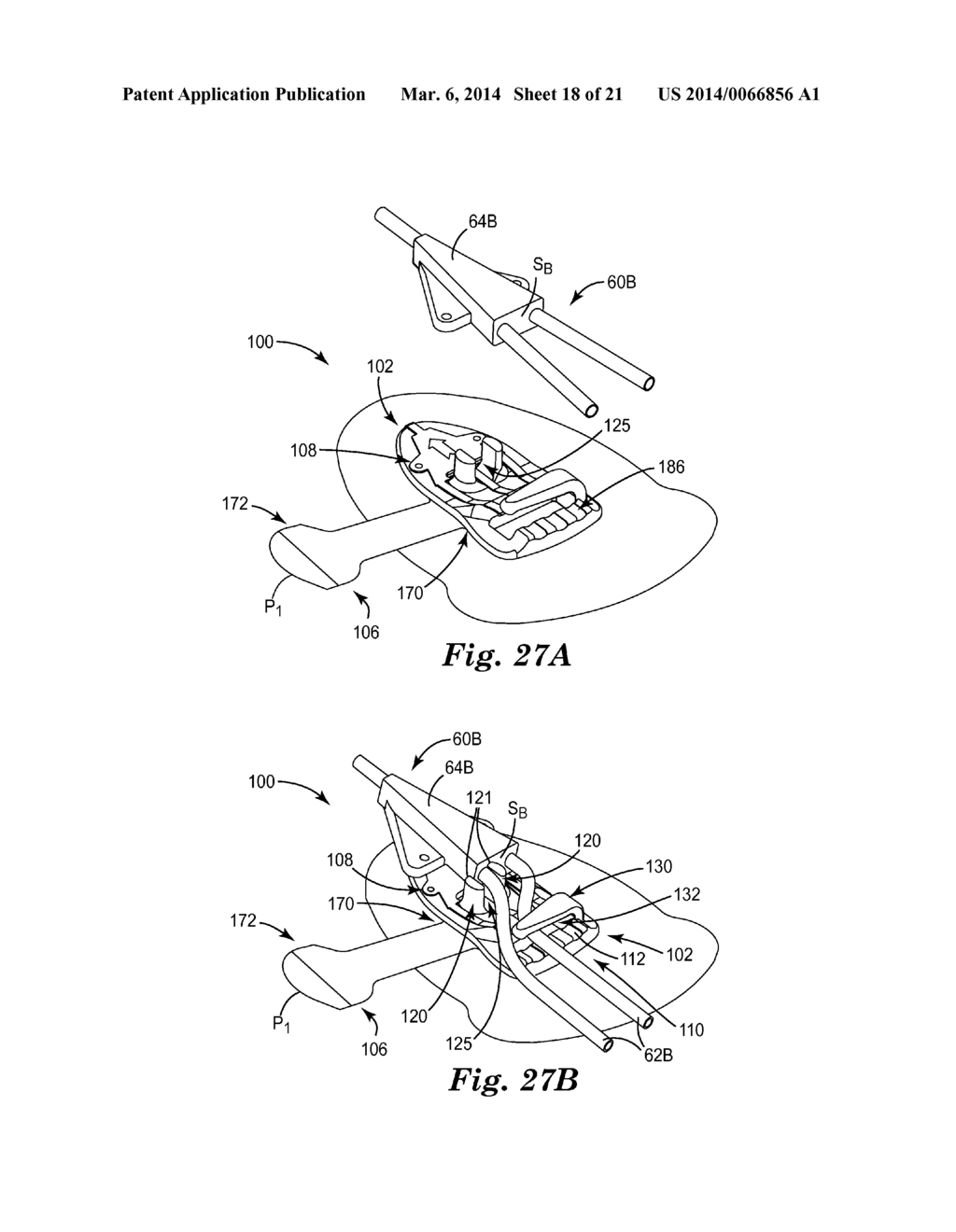 MEDICAL ARTICLE SECUREMENT SYSTEMS COMPRISING A BRACKET AND A FLAP - diagram, schematic, and image 19