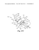 MEDICAL ARTICLE SECUREMENT SYSTEMS COMPRISING A BRACKET AND A FLAP diagram and image