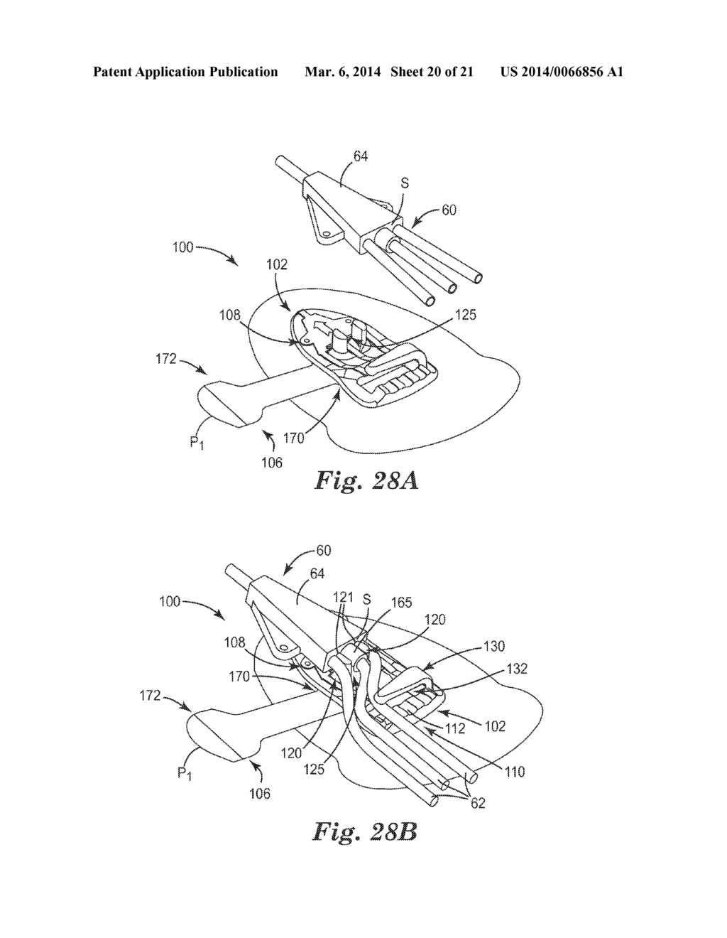 MEDICAL ARTICLE SECUREMENT SYSTEMS COMPRISING A BRACKET AND A FLAP - diagram, schematic, and image 21
