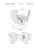 Anatomically Conforming Vaginal Insert With Cover diagram and image