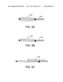 RETRACTABLE SHEATH DEVICES, SYSTEMS, AND METHODS diagram and image