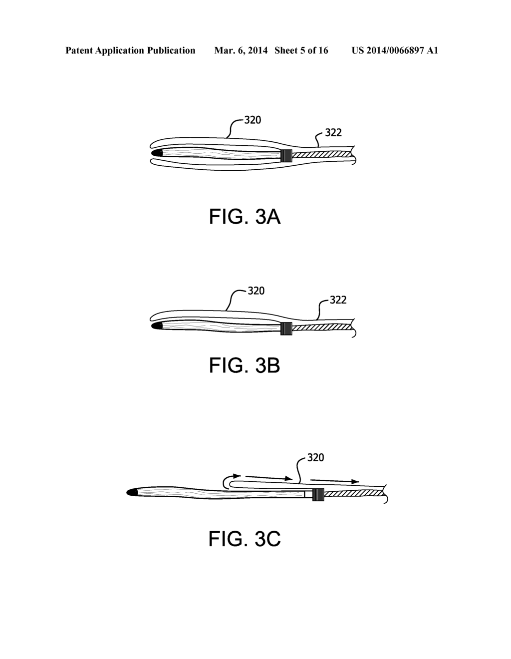 RETRACTABLE SHEATH DEVICES, SYSTEMS, AND METHODS - diagram, schematic, and image 06