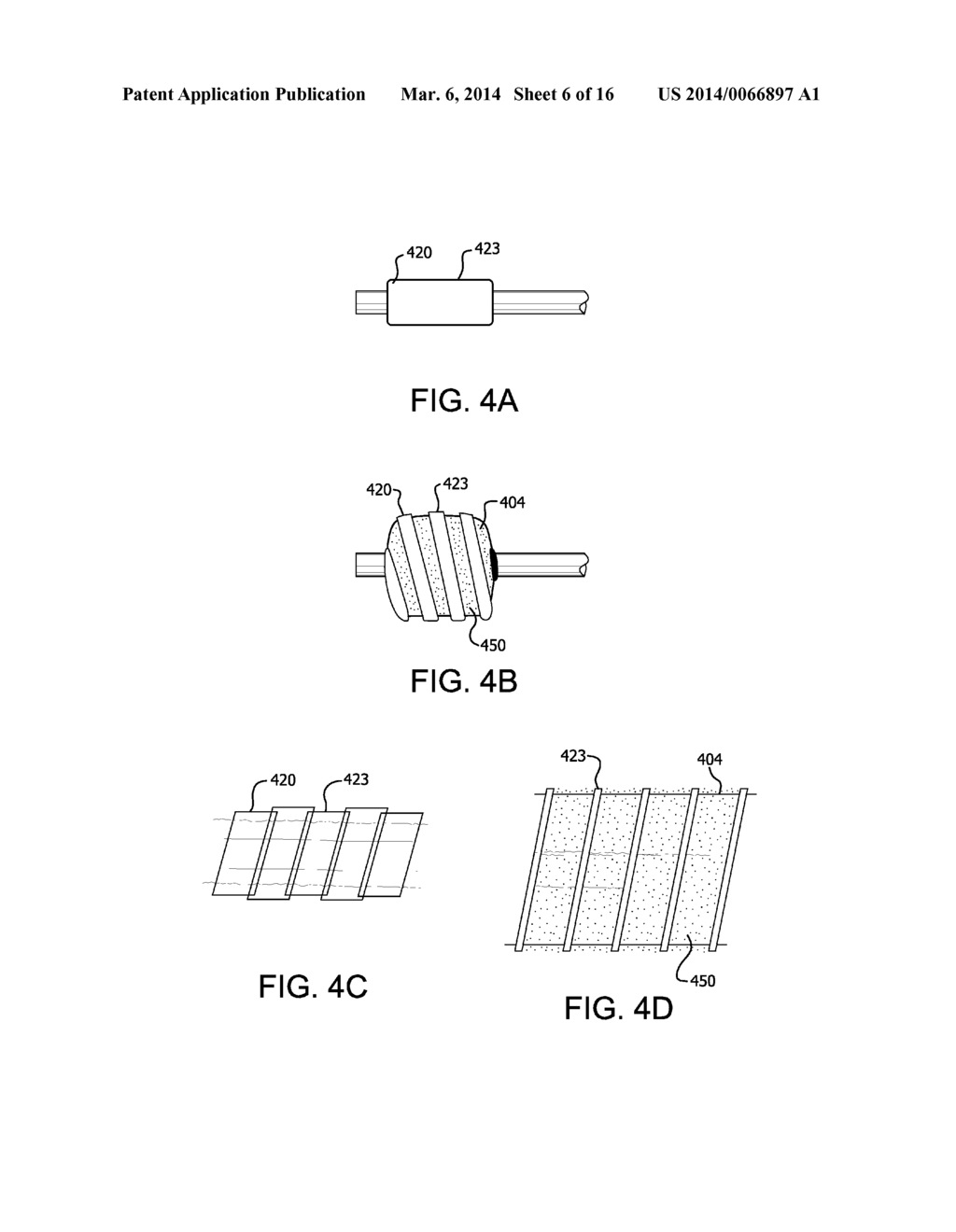 RETRACTABLE SHEATH DEVICES, SYSTEMS, AND METHODS - diagram, schematic, and image 07