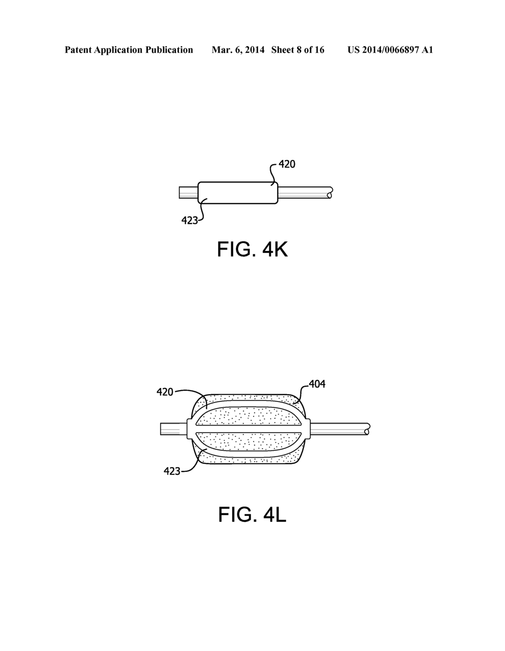 RETRACTABLE SHEATH DEVICES, SYSTEMS, AND METHODS - diagram, schematic, and image 09