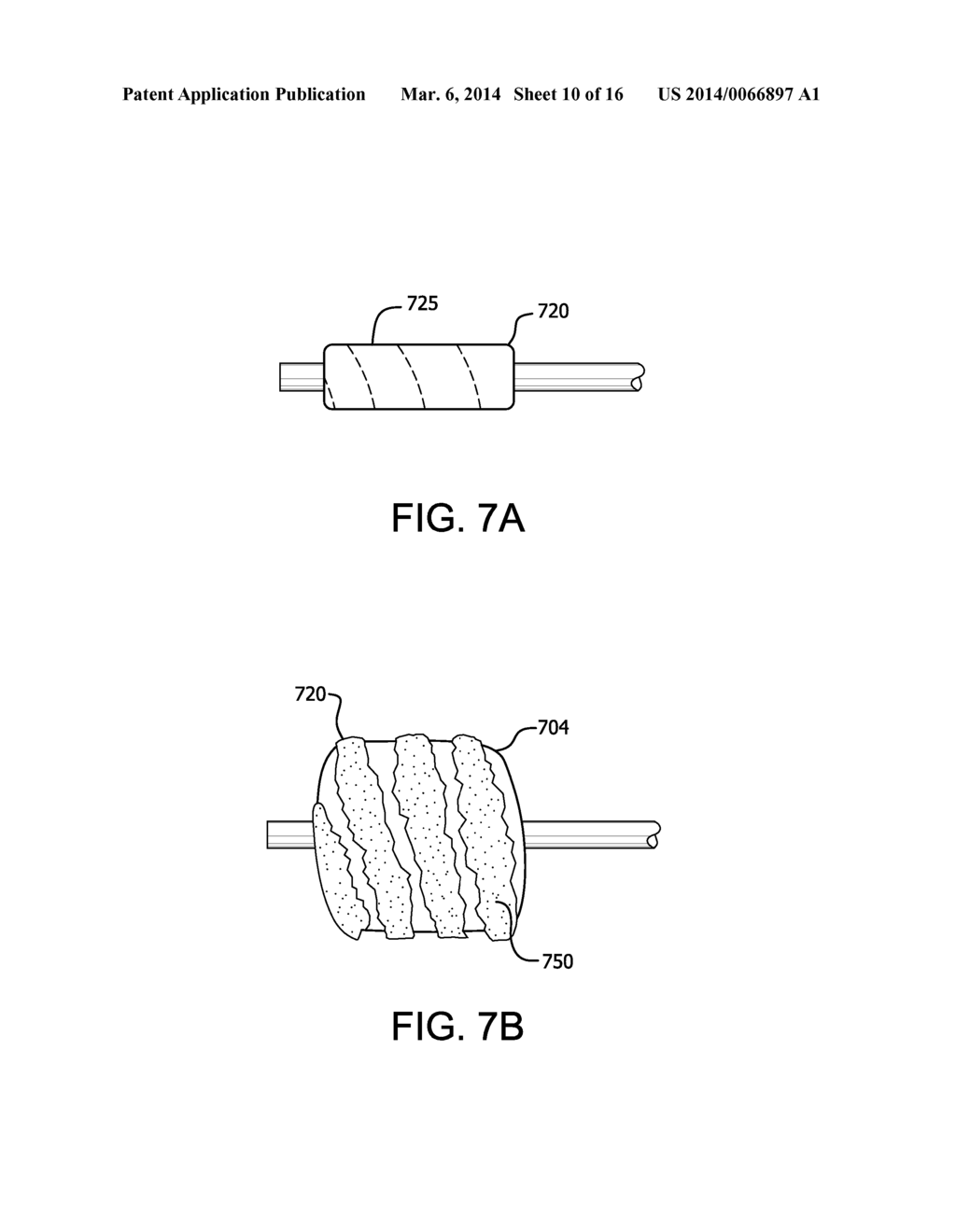 RETRACTABLE SHEATH DEVICES, SYSTEMS, AND METHODS - diagram, schematic, and image 11