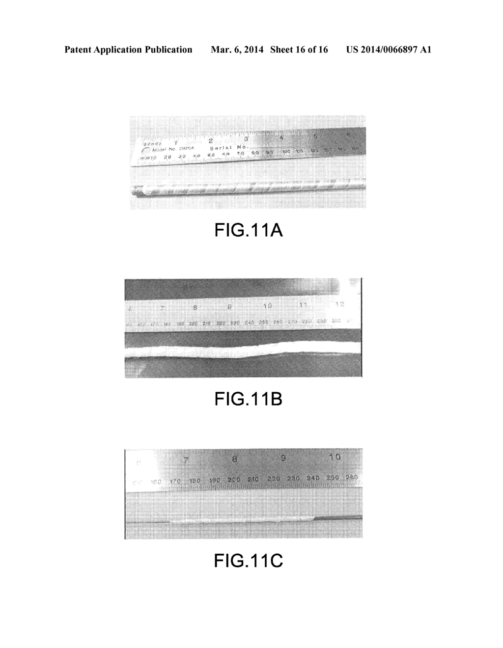 RETRACTABLE SHEATH DEVICES, SYSTEMS, AND METHODS - diagram, schematic, and image 17