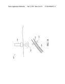 BALLOON CATHETER NEUROMODULATION SYSTEMS diagram and image