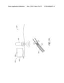 BALLOON CATHETER NEUROMODULATION SYSTEMS diagram and image