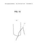 PATIENT SPECIFIC IMPLANT POSITIONING diagram and image