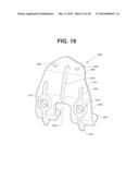 PATIENT SPECIFIC IMPLANT POSITIONING diagram and image