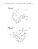 PATIENT SPECIFIC IMPLANT POSITIONING diagram and image