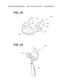 PATIENT SPECIFIC IMPLANT POSITIONING diagram and image