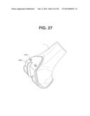 PATIENT SPECIFIC IMPLANT POSITIONING diagram and image