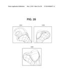 PATIENT SPECIFIC IMPLANT POSITIONING diagram and image