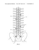 BONE FASTENER AND METHODS OF USE diagram and image