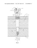 BONE FASTENER AND METHODS OF USE diagram and image