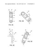 IMPLANT SUITABLE FOR CALCANEAL OSTEOTOMY diagram and image