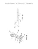 IMPLANT SUITABLE FOR CALCANEAL OSTEOTOMY diagram and image