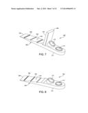 IMPLANT SUITABLE FOR CALCANEAL OSTEOTOMY diagram and image