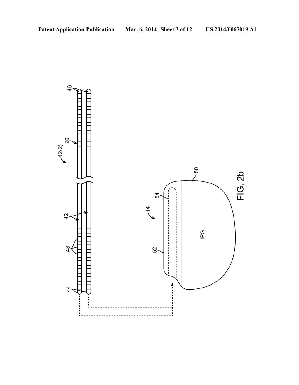 SYSTEM AND METHOD FOR CONNECTING DEVICES TO A NEUROSTIMULATOR - diagram, schematic, and image 04