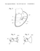 Heart Valve Sealing Devices diagram and image