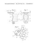 Heart Valve Sealing Devices diagram and image