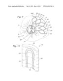 Heart Valve Sealing Devices diagram and image