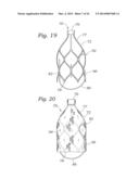 Heart Valve Sealing Devices diagram and image