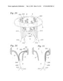 Heart Valve Sealing Devices diagram and image