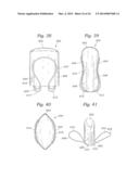 Heart Valve Sealing Devices diagram and image