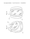 Heart Valve Sealing Devices diagram and image