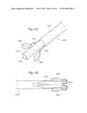 Heart Valve Sealing Devices diagram and image