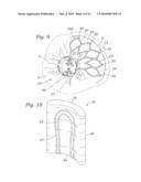 Heart Valve Sealing Devices diagram and image