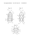 Heart Valve Sealing Devices diagram and image