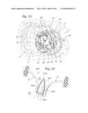 Heart Valve Sealing Devices diagram and image