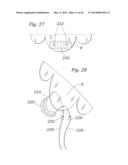 Heart Valve Sealing Devices diagram and image