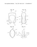 Heart Valve Sealing Devices diagram and image