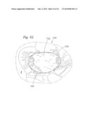 Heart Valve Sealing Devices diagram and image