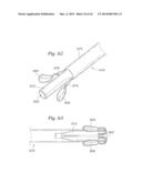 Heart Valve Sealing Devices diagram and image