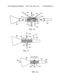 SOFT TISSUE REPAIR DEVICES, SYSTEMS, AND METHODS diagram and image