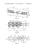 SOFT TISSUE REPAIR DEVICES, SYSTEMS, AND METHODS diagram and image