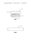 ADJUSTABLE INTERVERTEBRAL IMPLANT diagram and image