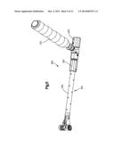 ADJUSTABLE INTERVERTEBRAL IMPLANT diagram and image