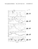 KINEMATIC ROAD GRADIENT ESTIMATION diagram and image