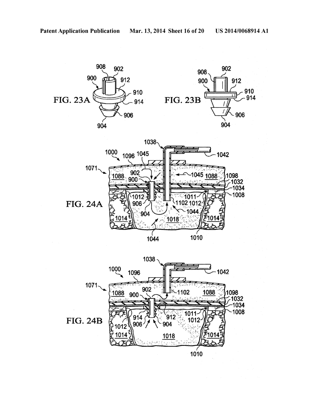 REDUCED-PRESSURE, ABDOMINAL TREATMENT SYSTEMS AND METHODS - diagram, schematic, and image 17