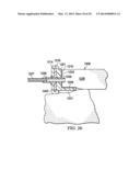 REDUCED-PRESSURE, ABDOMINAL TREATMENT SYSTEMS AND METHODS diagram and image