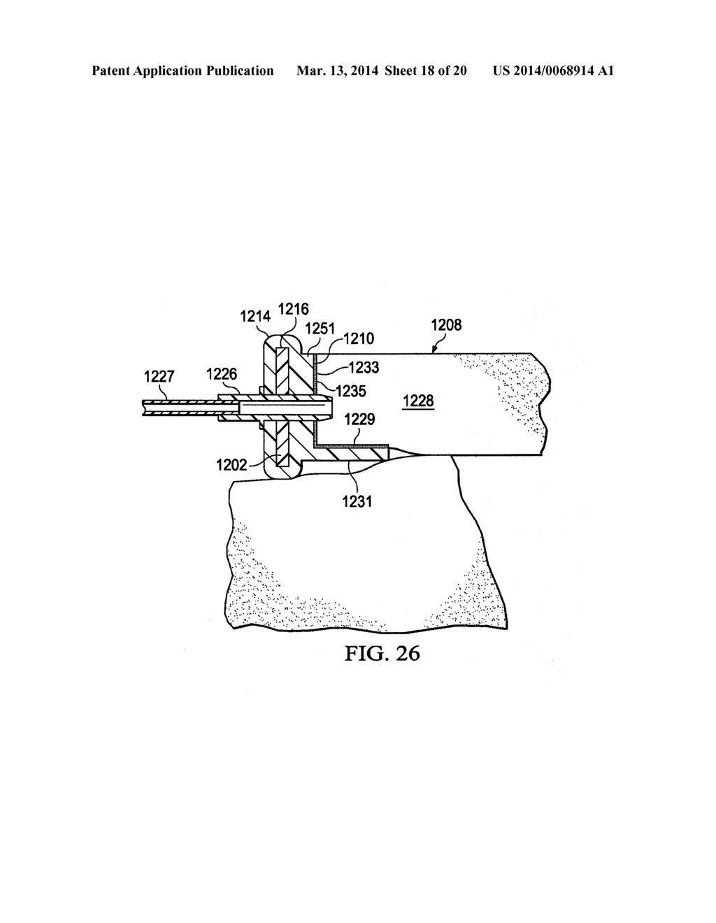 REDUCED-PRESSURE, ABDOMINAL TREATMENT SYSTEMS AND METHODS - diagram, schematic, and image 19