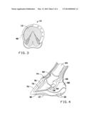 EQUINE BONY COLUMN AND TISSUE SUPPORT WITH UNIFORM LOAD DISTRIBUTION TO     ALL HOOF STRUCTURES AND A METHOD FOR USING THE SAME diagram and image